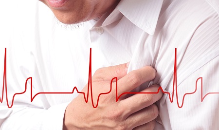 Bệnh tim là một trong những nguyên nhân gây ra tai biến mạch máu não